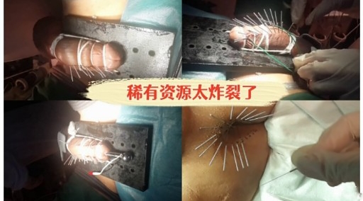 稀有资源太炸裂了