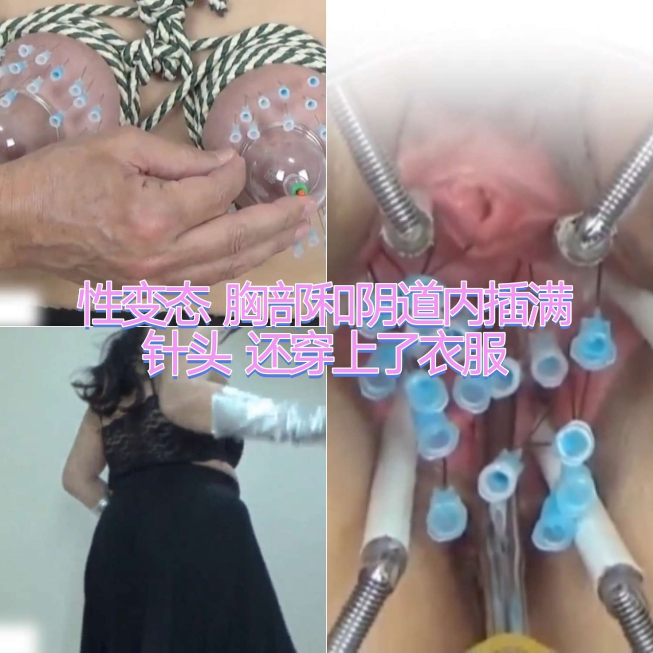 性虐恋胸部和阴道内插满针头还穿上了衣服