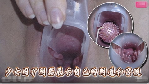少女用扩阴器展示自己的阴道和宫颈