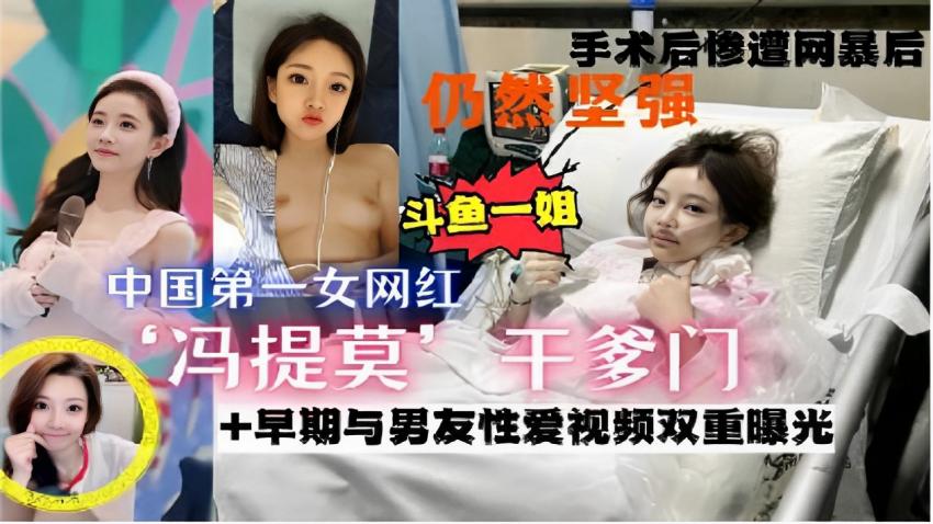 手术后惨遭网暴仍然坚强斗鱼一姐中国第一女网红冯提莫 干爹门+早期与男友性爱视频双重曝光
