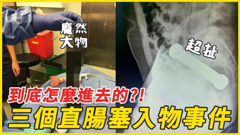 【性学小教室102】到底怎么进去的？｜最扯的三个直肠塞入物真实事件
